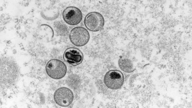 Affenpockenviren sind nicht mit den Coronaviren vergleichbar. 