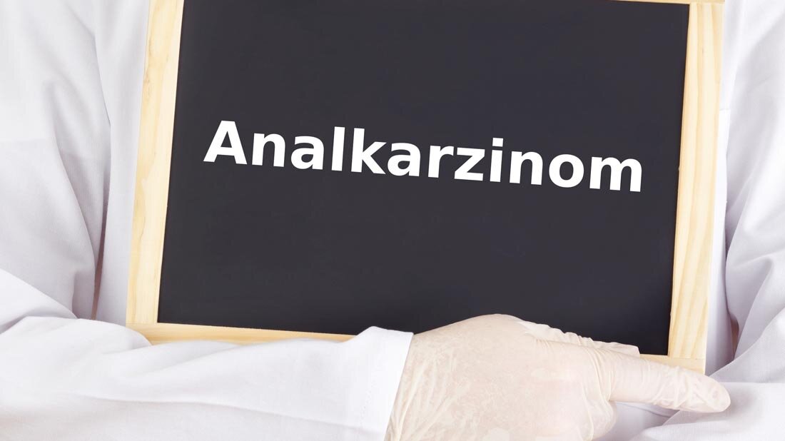 Analkarzinom.jpg Analkrebs: Screeing verbessern