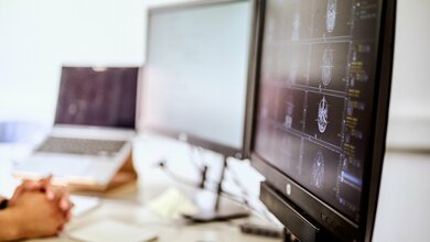 Analyse von MRT-Daten mittels KI