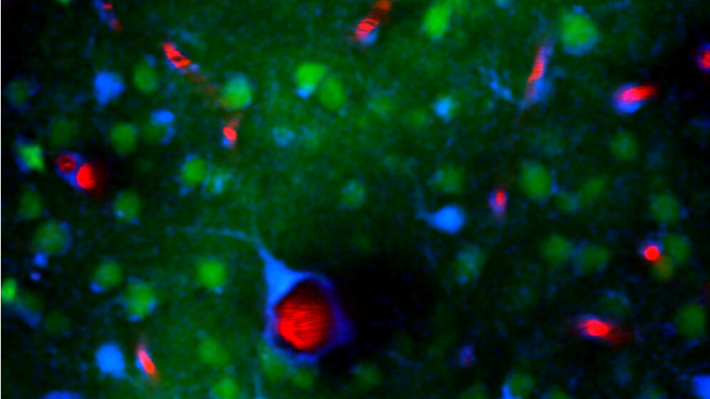 Hirnzellen_einer_Maus_Blutgefaesse_sind_rot_DZNE_Cordula_Rakers.jpg Mikroskopische Aufnahme zeigt Hirnzellen