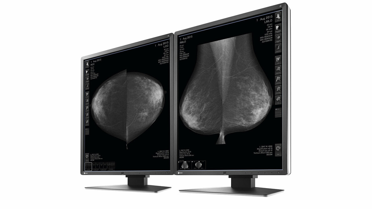 Neuer 5-Megapixel-Schirm von EIZO RadiForce GX550
