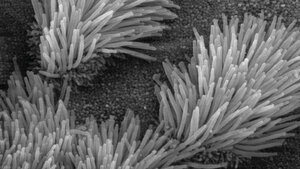 Pilzinfektionen bei Mukoviszidose