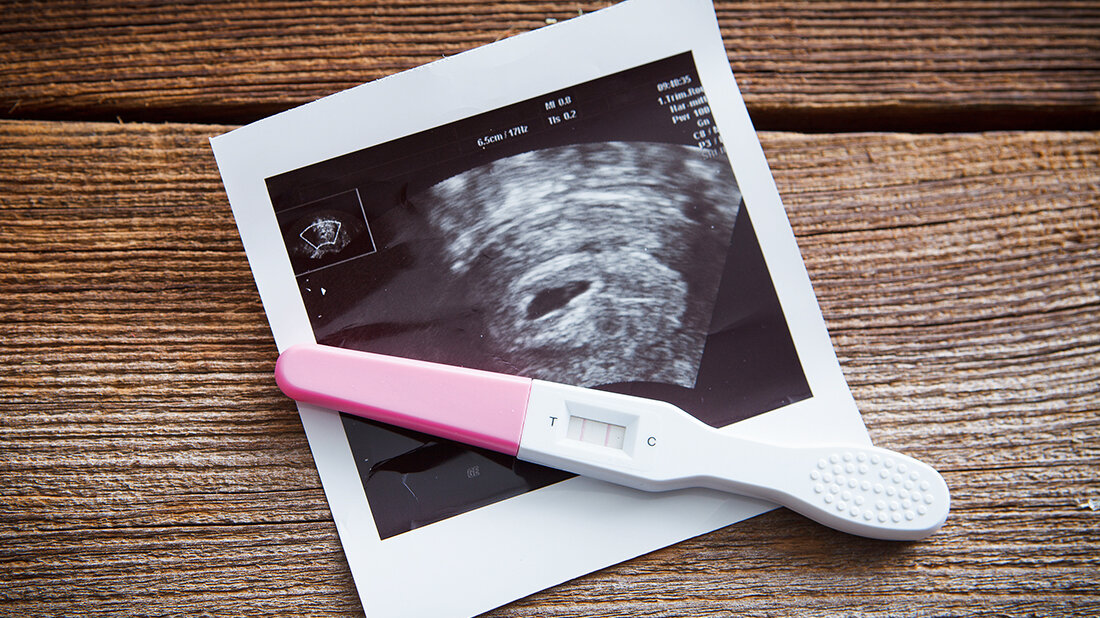 Titelbild zum englischen Beitrag über Schwangerschaftstests