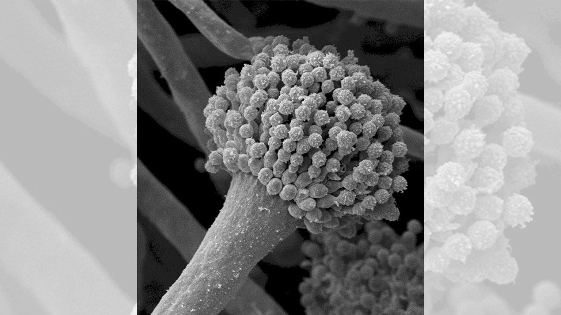 Rasterelektronenmikroskopische Aufnahme eines Sporenträgers von A. fumigatus. 