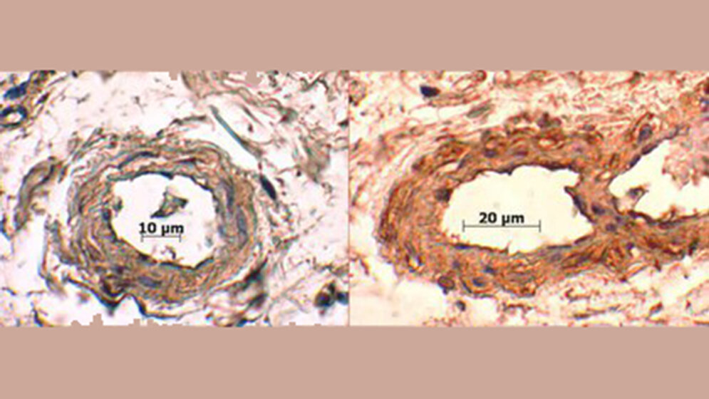 Der Einfluss von Strom auf Antikörper Immunhistologie