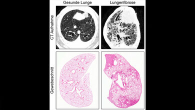 Schwere Lungenfibrose im Tiermodell