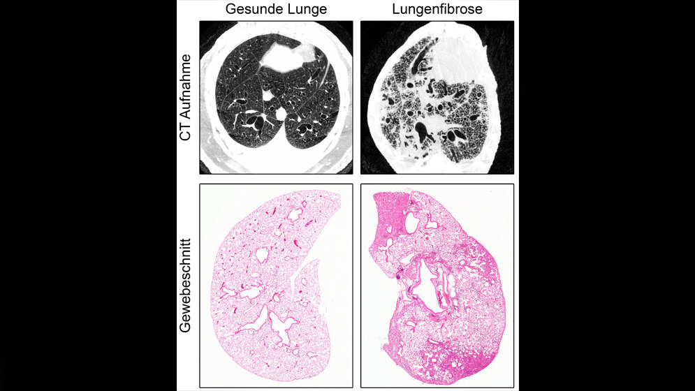 Schwere Lungenfibrose im Tiermodell