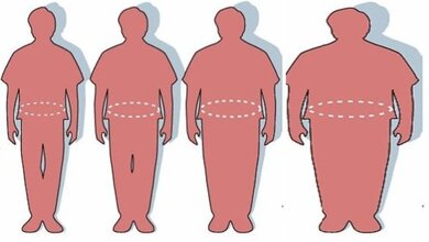 Obesity_Mike_Licht_CC_BY_2_01042016.jpg Adipositas