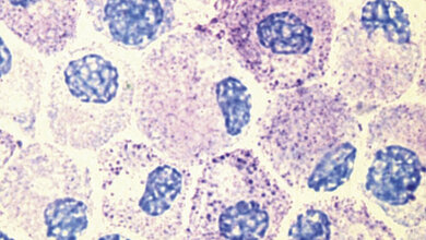 Das Mastzellaktivierungssyndrom