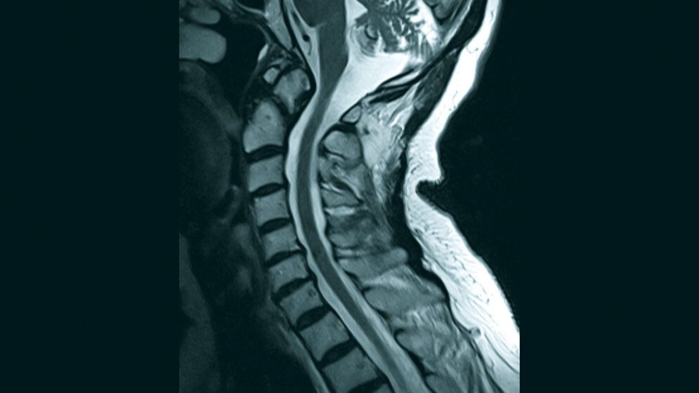 Anomalien und Normvarianten