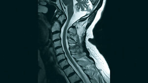 Anomalien und Normvarianten