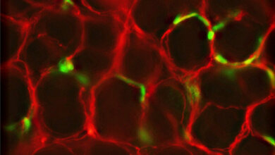 Zellen_Enterischen_Nervensystems_HS_Kaiserslautern_16082016.jpg Zellen des Enterischen Nervensystems