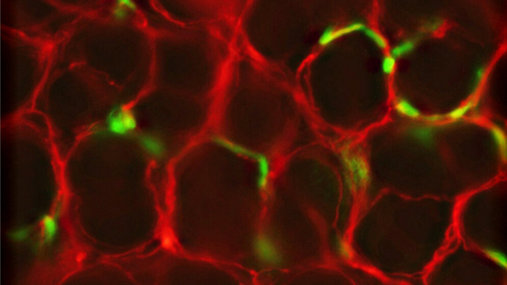 Zellen des Enterischen Nervensystems