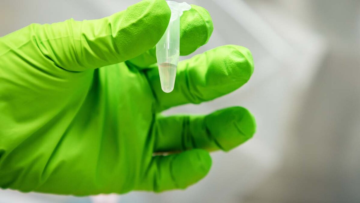 Abwasserprobe vor der Sequenzierung.