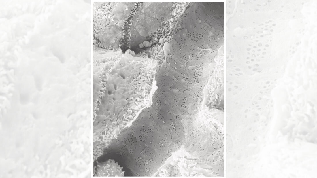 Fenster_in_Blutgefaessen_der_Leber.jpg Aufnahme eines kleinen Blutgefäßes der Leber mit den Fenstern