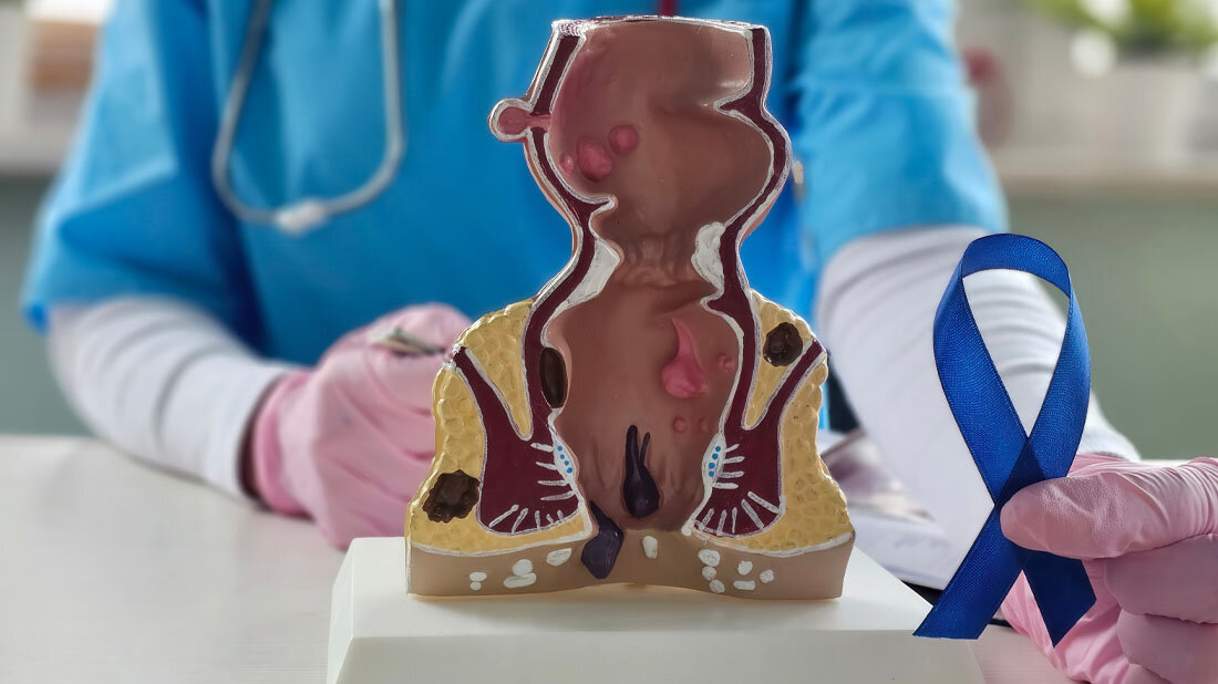 Arzt für Onkologie des menschlichen Verdauungssystems mit blauer Schleife in der Klinik.