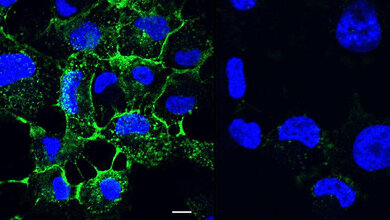 LecA.jpg Ein LecA- Inhibitor kann das Anheften des Krankenhauskeims Pseudomonas aeruginosa an Wirtszellen verhindern.