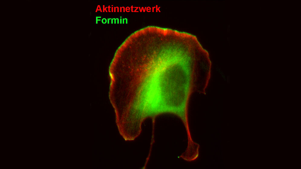 Melanomzelle bei der Wanderung