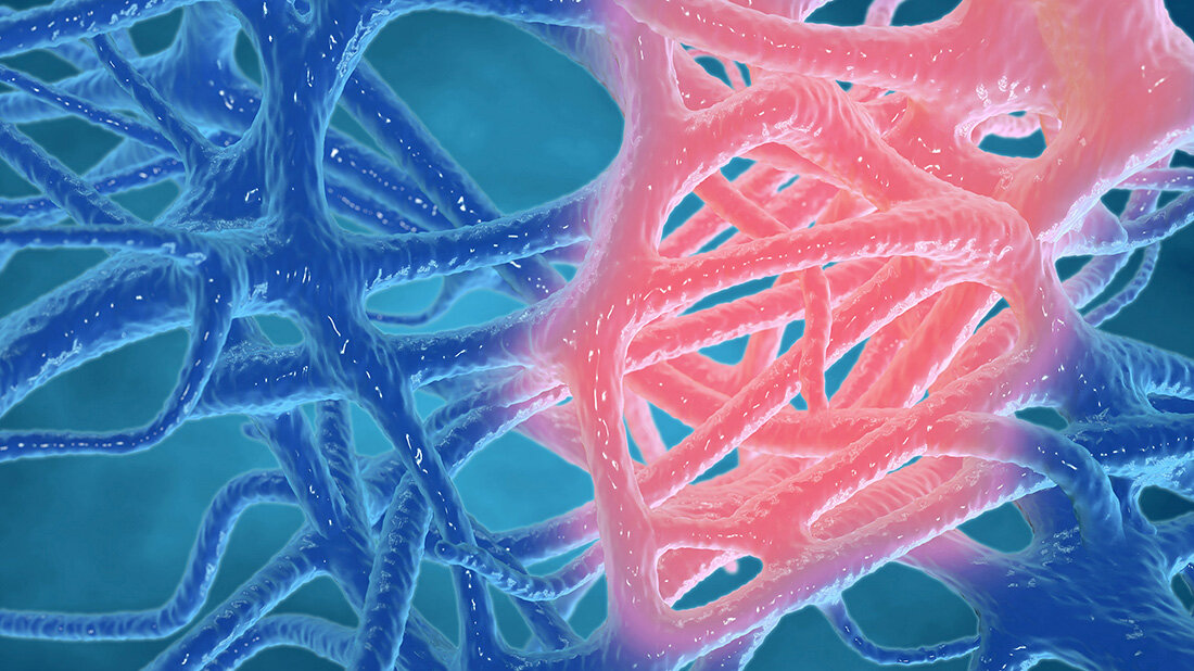 Entzuendung.jpg Entzündungsreaktion