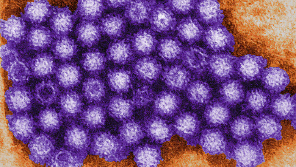 Norovirus