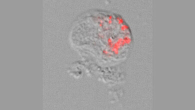Lichtmikroskopische Aufnahme einer Amöbe der Thecofilosea