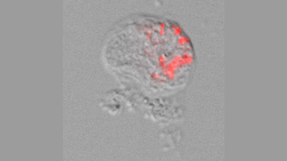 Thecofilosea.jpg Lichtmikroskopische Aufnahme einer Amöbe der Thecofilosea