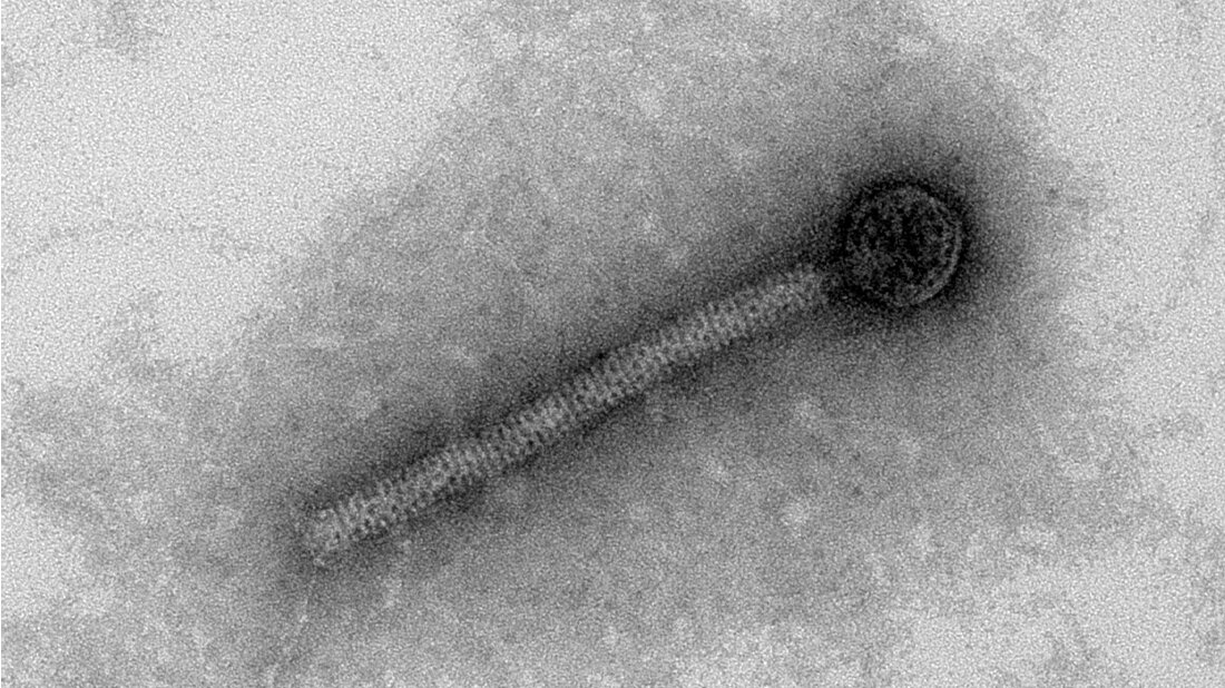 Bakteriophage.jpg Transmissionselektronenmikroskopische Aufnahme eines Bakteriophagen