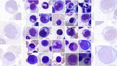 KI_Helmholtz_Munich_Carsten_Marr.jpg KI in der Diagnostik
