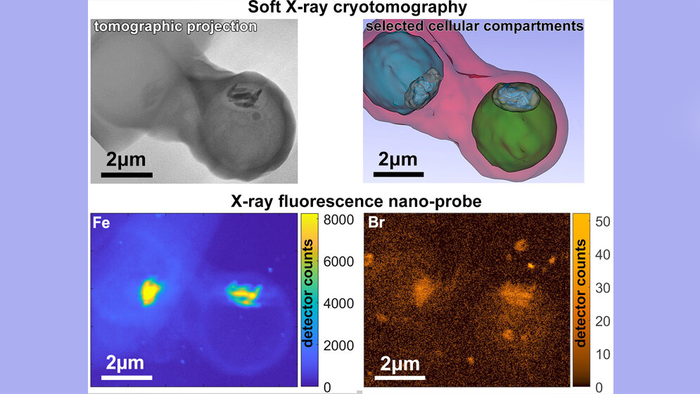 Messmethoden_an_den_Synchrotronquellen_BESSY_II_ALBA_und_ESRF_S_Kapishnikov.jpg Kombination mehrerer Messmethoden an den Synchrotronquellen BESSY II, ALBA und ESRF