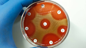 Titelbild des Fachbeitrags zum Risiko durch Scharlachausbrüche