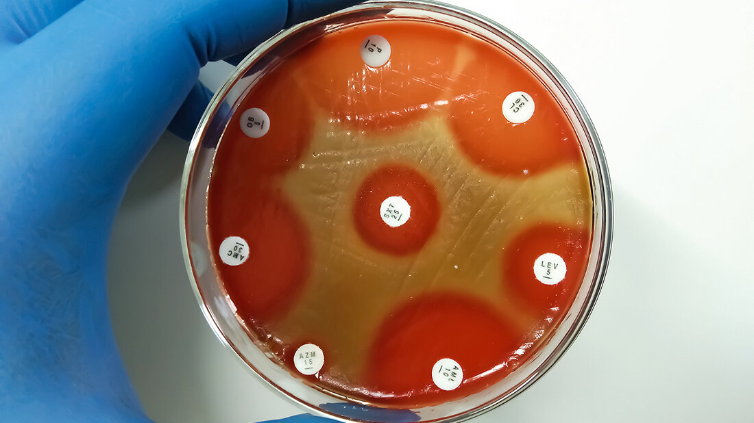 Titelbild des Fachbeitrags zum Risiko durch Scharlachausbrüche