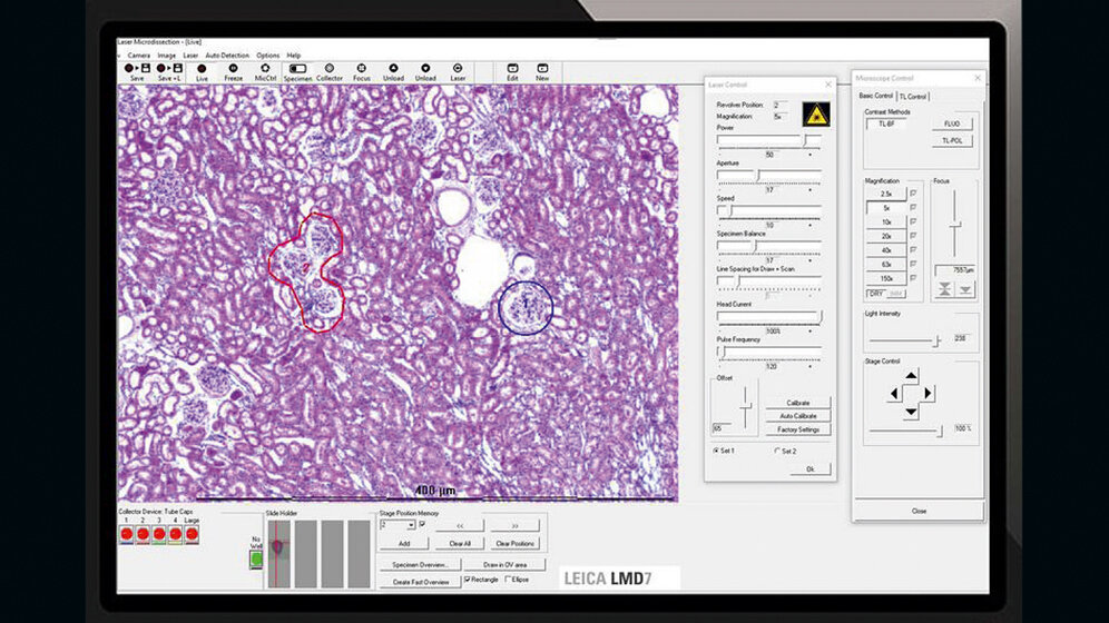 Aus der Industrie Neue LMD Software 8.2