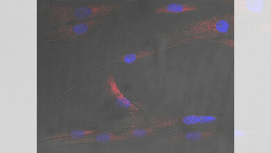 menschlicher Muskelzellen mit Zellkernen (blau) und Stress