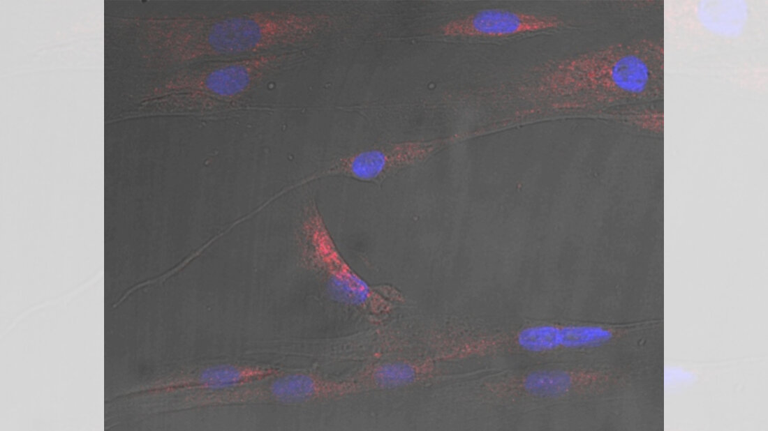Muskelzellen_mit_Zellkernen_blau_und_Stress.jpg menschlicher Muskelzellen mit Zellkernen (blau) und Stress