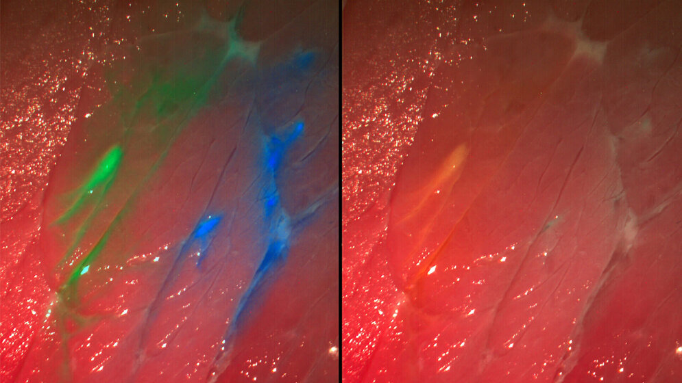 neue Kamera mit Fluoreszenzfarbstoffen