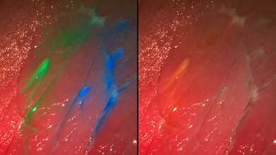 neue Kamera mit Fluoreszenzfarbstoffen