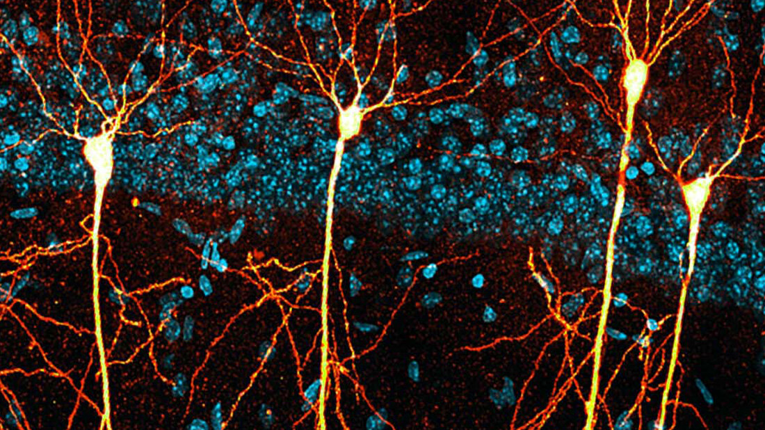 Neuronales Signalosom als Schlüssel zur Behandlung der Alzheimer-Krankheit erforscht