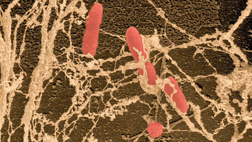 Pseudomonas aeruginosa 