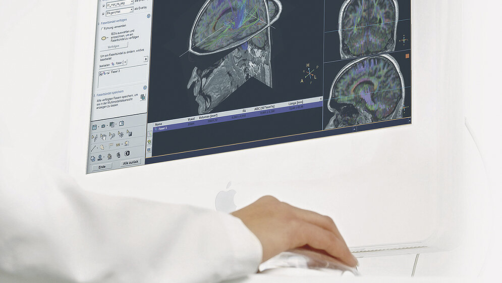 Computermonitor mit CT