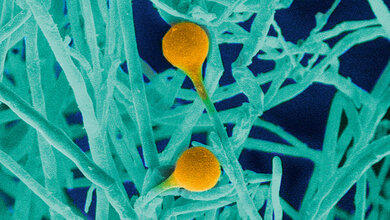 Schimmelpilze Teil 3: Mucor