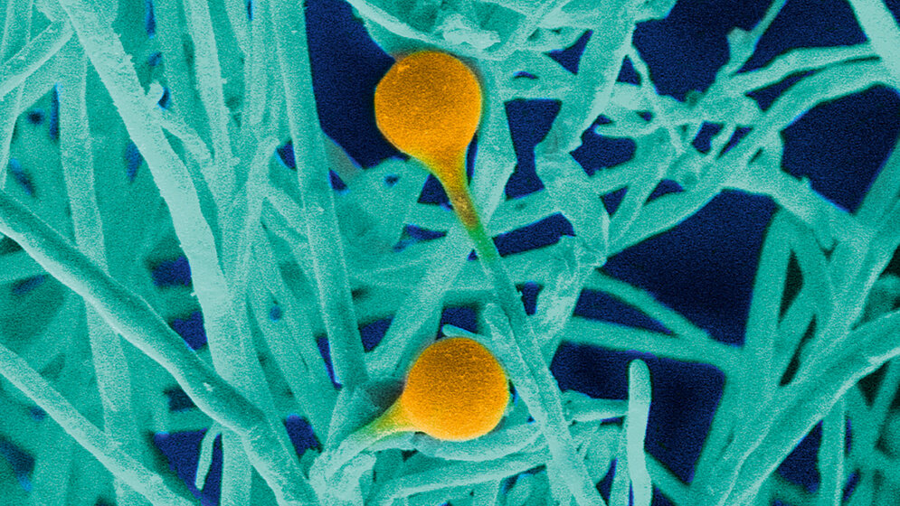 Schimmelpilze Teil 3: Mucor