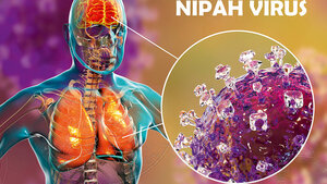 Titelbild für den Fachbeitrag über die Nipah-Virus-Infektion