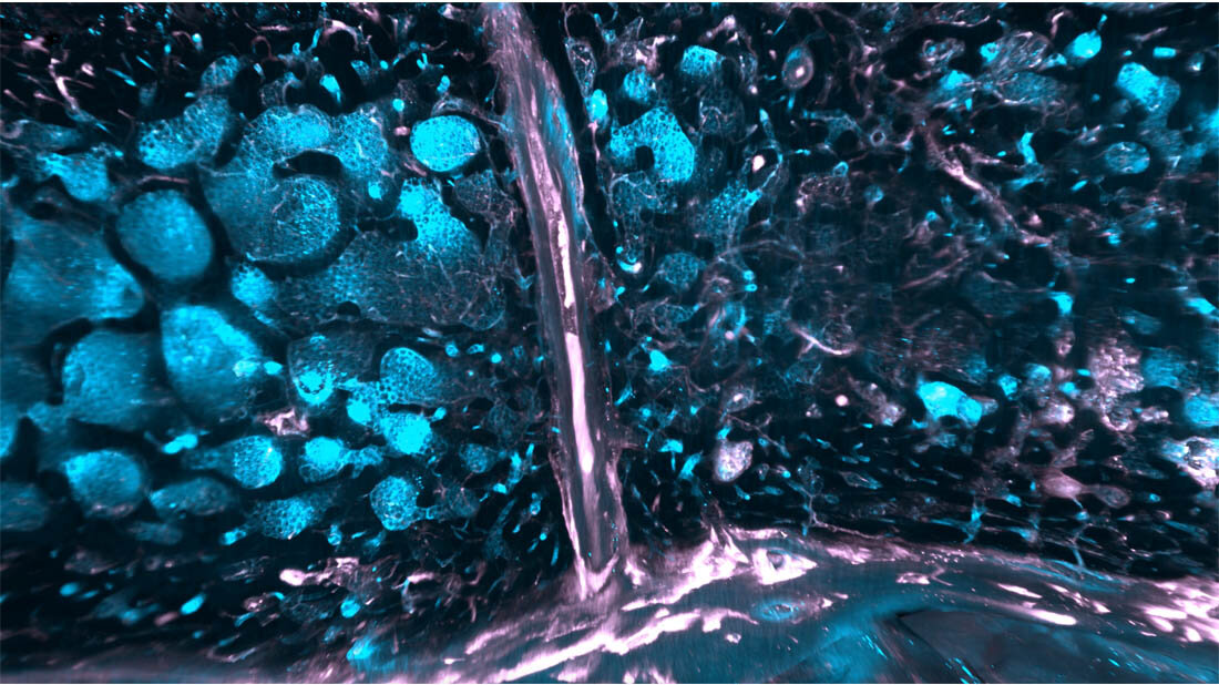 Knochenmark_des_Schaedels.jpg Knochenmark des Schädels