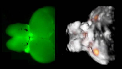 Nervenzellen.jpg Nervenzellen