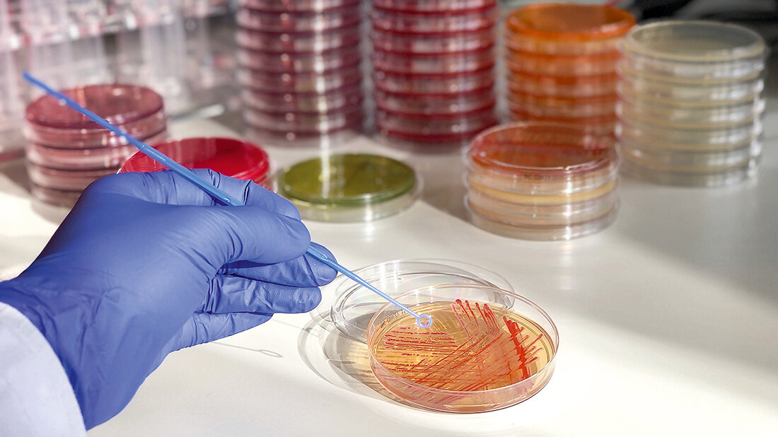 Titelbild zum Fachbeitrag „Carbapenem resistente Enterobacterales“