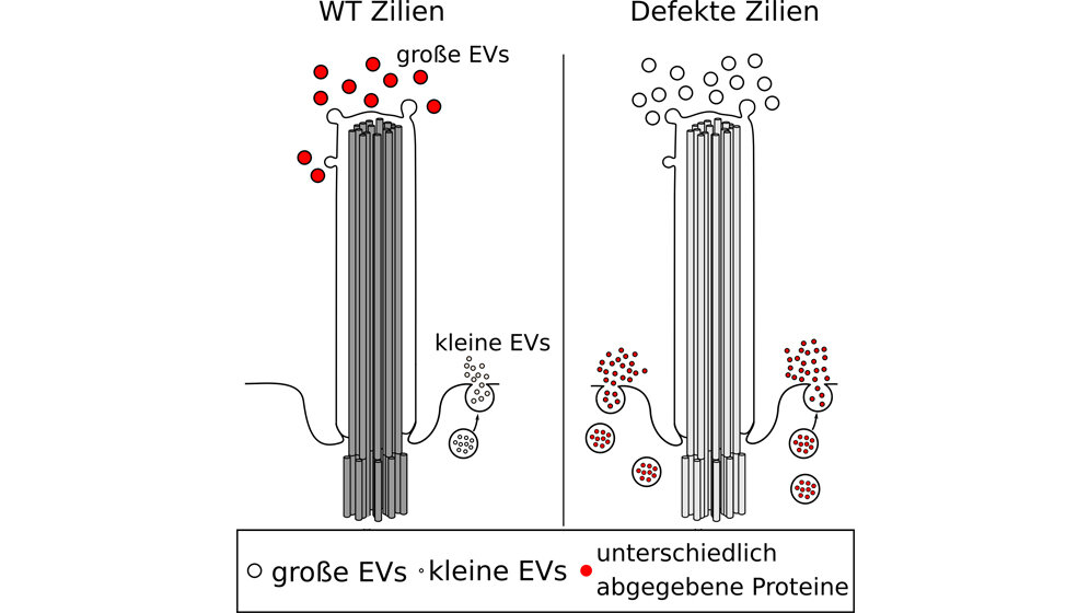 Fehlfunktion der Primärzilie