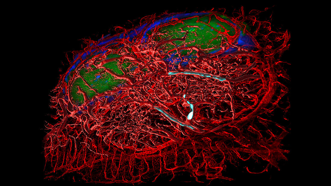 Immunschwäche Darmgewebe Maus