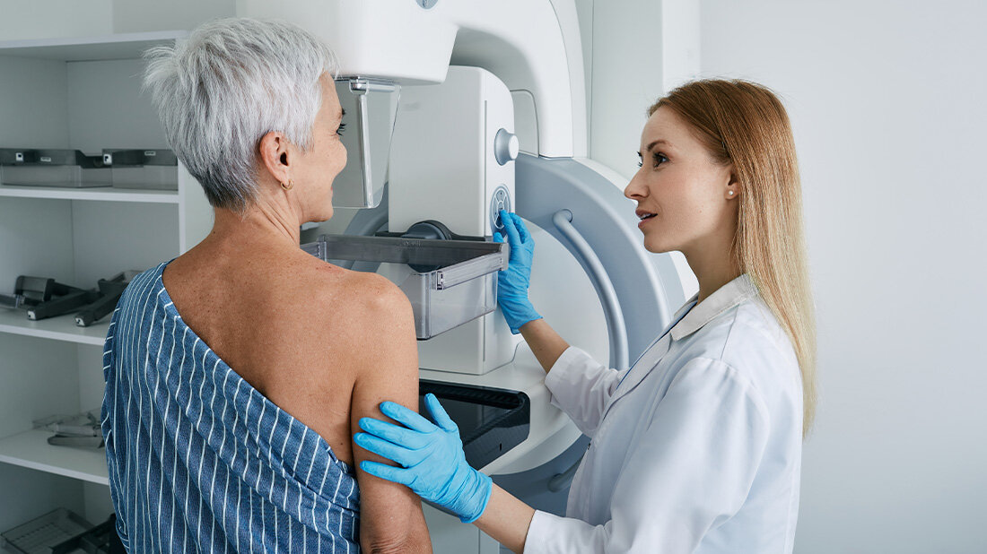 Fruehstadium_Brustkrebs.jpg Langzeitdaten belegen: Terilbrustbestrahlung bei frühem Brustkrebs ebenbürtig