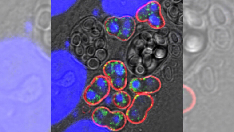 Immunofuoreszenzmikroskop-Aufnahme 