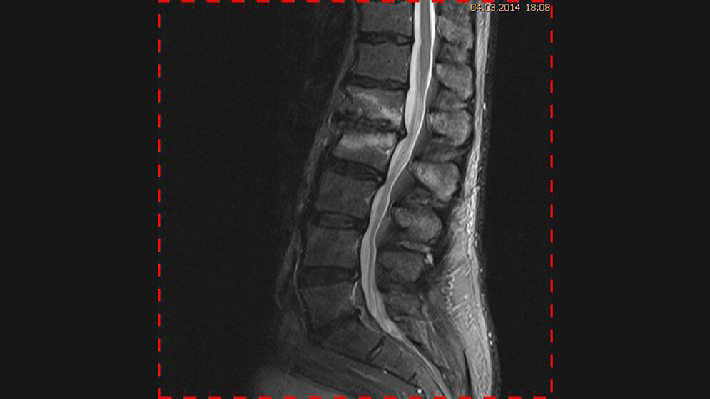 Schnittbilddiagnostik der Wirbelsäule (1.13)
